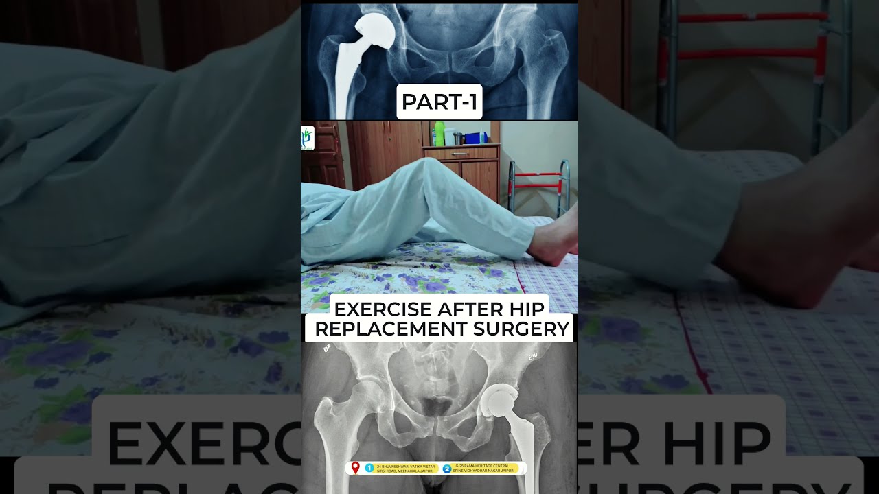 Exercise After Hip Replacement Surgery Part 1 Drsuniltank