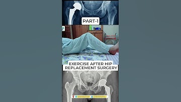 Exercise after hip replacement surgery ✅ Part -1 #Drsuniltank