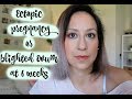 UPDATE | ECTOPIC PREGNANCY, SLOW RISING HCG, BLIGHTED OVUM????