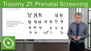 Trisomy 21: Prenatal Screening – Pediatrics | Lecturio screenshot 5