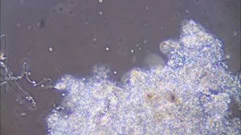 granular sludge swimming ciliate