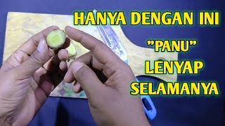 Cara Cepat Menghilangkan Panu Secara Alami || Manfaat Lengkuas