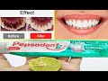 Teeth Whitening At Home In Just 5 Minutes| Turn dirty yellow teeth to white teeth Naturally 100%Work