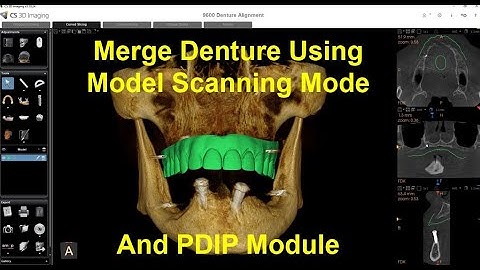 CS 3D Imaging - Denture Scan and Merge PDIP