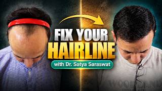 Hair Transplant in India | 3200 Grafts | Real Patient Experience & Results by Dr. Satya Saraswat