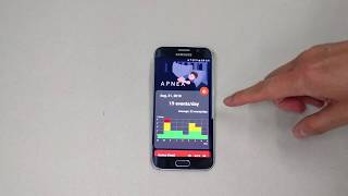 RESPIO APP screenshot 3