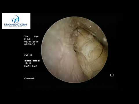 youtube video preview