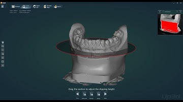 Acublu UP300 UP360 dental scanner big articulator scan
