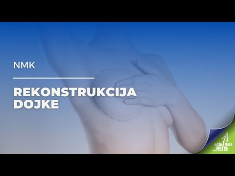 Rekonstrukcija dojke