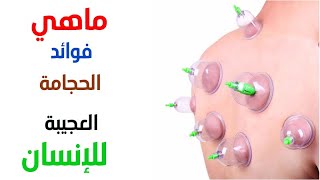 146 - تعرف على الحجامة وفوائدها المذهلة على الجسم