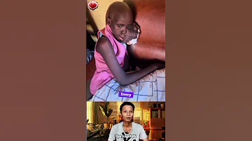 A Woman S Fight Against A Rare And Devastating Disease Shorts Luuhuynhthi Subhanallah 