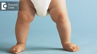 How many times does a newborn baby pass stool? - Dr. Prathap Chandra