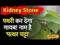Kidney stone              health tips  local18