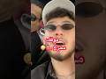موقف محرج في حفل الشامي