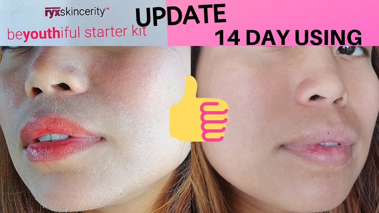 14 day UPDATE using RYX Skincerity Rejuvenating Set | 2019 - YouTube
