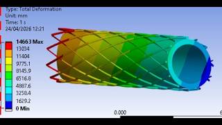 Cad Design Fea Analysis Of Cardiovascular Coronary Artery Stent Balloon316L Ss Stainless Steel