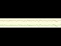 Electrical brain activity with novel stretchable electrodes-SV1 ID 224243