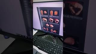 «Морфология зубов1» Вакита Дайю Видео @dt.stepangalanyan