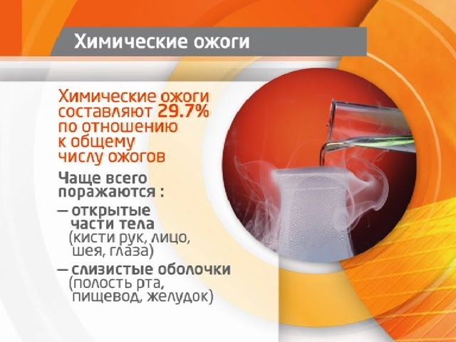 Химические ожоги