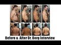 Ketosis  intermittent fasting  beforeafter dr berg skype with joe busuttil