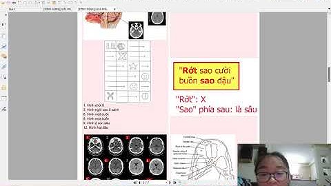 Hướng dẫn đọc ct scanner sọ não