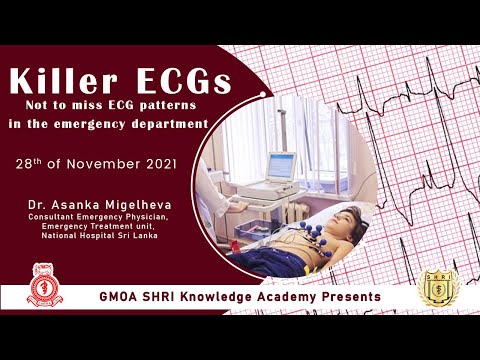 ABC in ECG Killer ECGs- ECG made easy