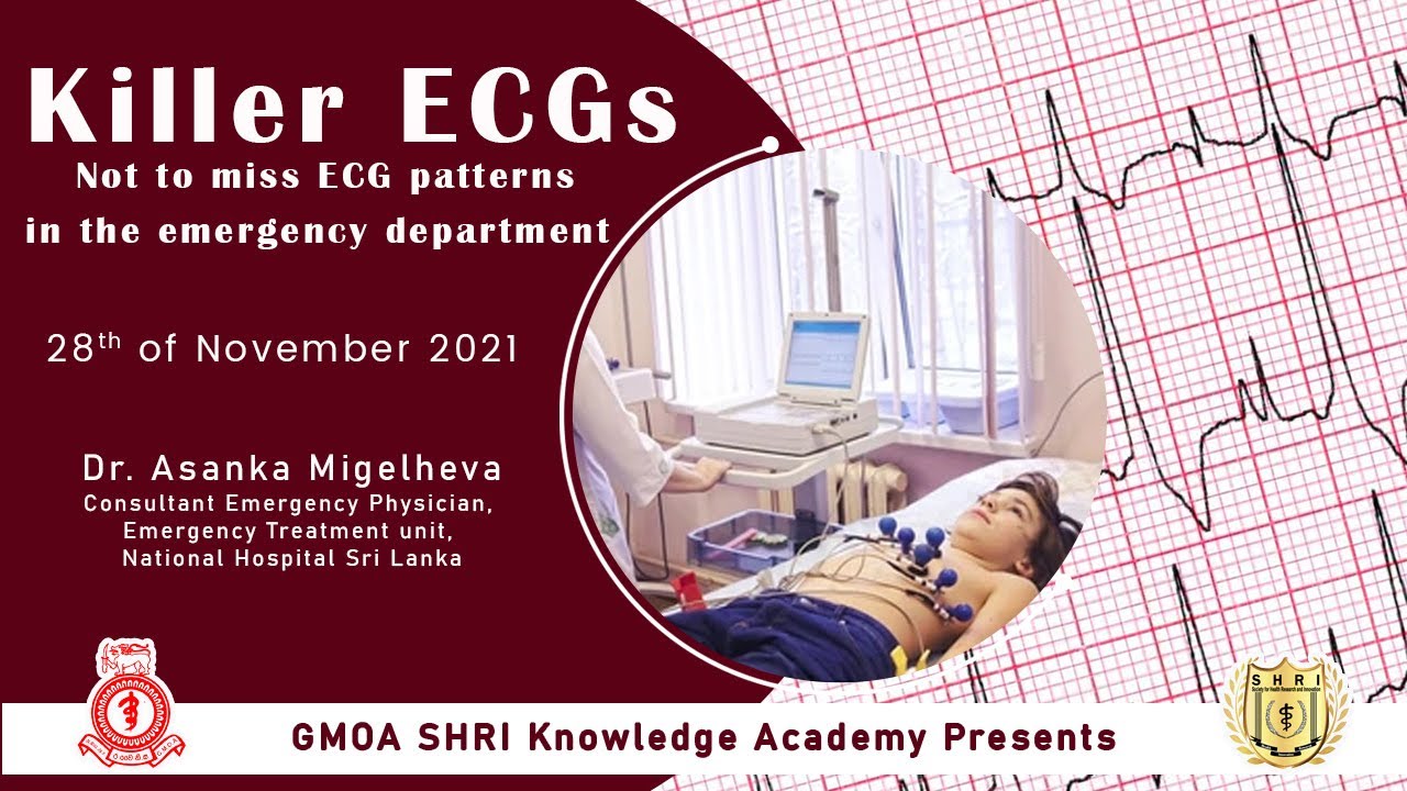 ABC in ECG Killer ECGs- ECG made easy