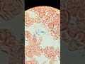 دم الانسان تحت الميكروسكوب (المجهر )
