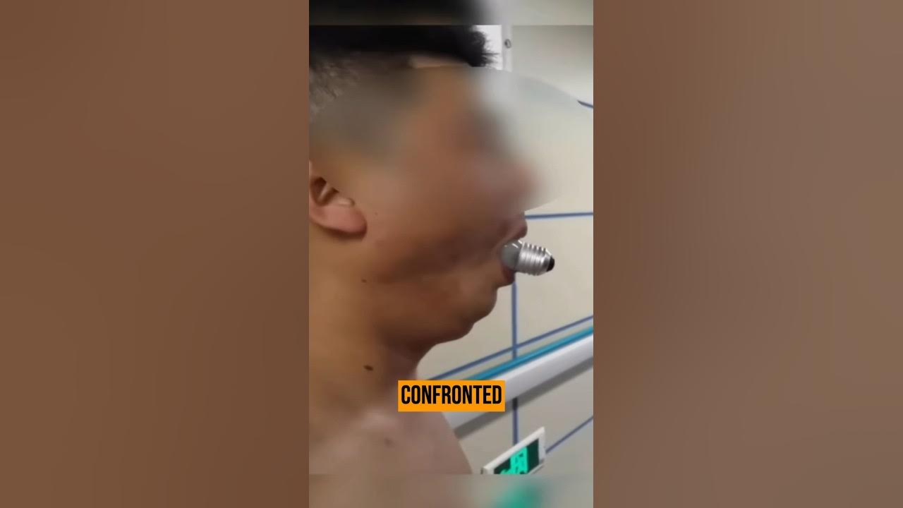 man-gets-light-bulb-stuck-in-mouth-while-attempting-stupid-online