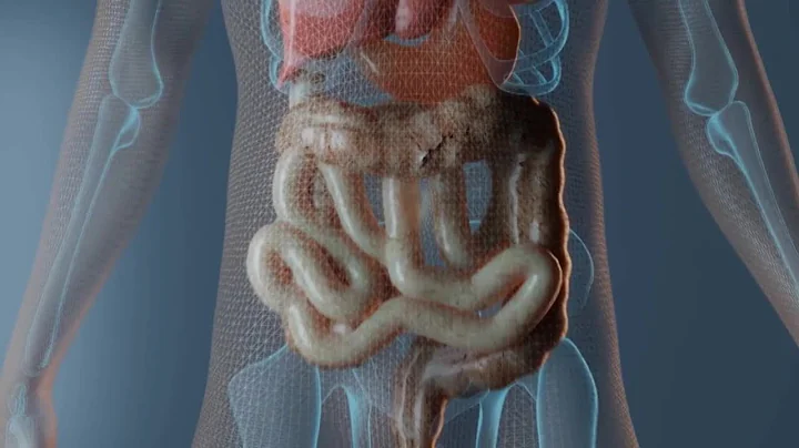 Your Healthy Family: Is your ongoing gas, bloating and stomach pain SIBO?