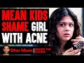 MEAN KIDS Shame Girl With ACNE, Instantly Regret It (Behind The Scenes) | Dhar Mann Studios