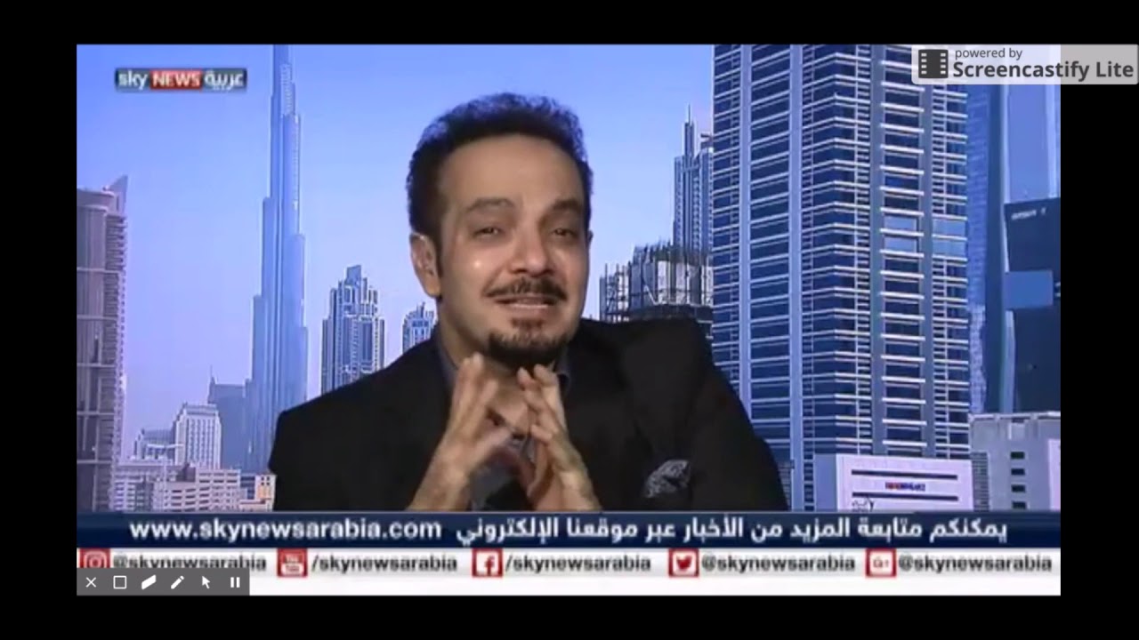 د. فايز غنام توحيد اللون لدى مرضى البهاق - على قناة سكاي نيوز