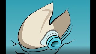 What Kids Need To Know About Grommets