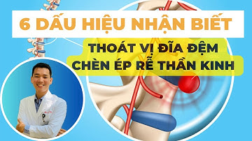 6 Dấu Hiệu Nhận Biết Thoát Vị Đĩa Đệm Chèn Ép Rễ Thần Kinh | Bác sĩ Tiến