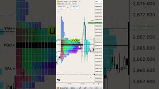 Want To Yze The Market More Effectively? Lets Talk About Tpo
