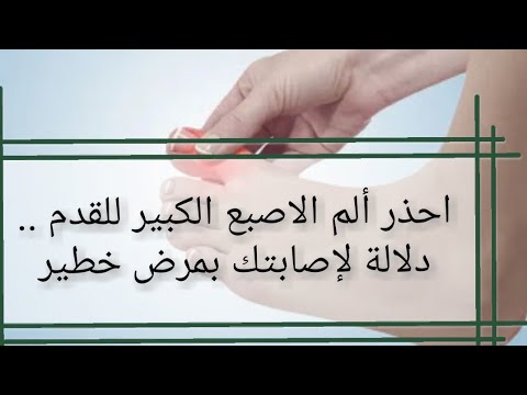 احذر ألم الاصبع الكبير للقدم دلالة لإصابتك بمرض خطير