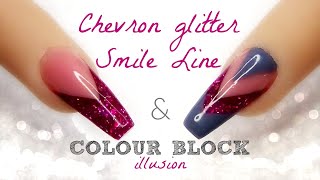 Chevron Glitter Smile-line & Colour Block Illusion