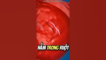 Nếu Bạn Bị Giun Móc 😨 (Bỏ Thói Quen Đi Chân Đất Ngay)