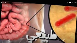 كنز متروس بروبيوتك للهضم وتحسين المود اوعو ترموه