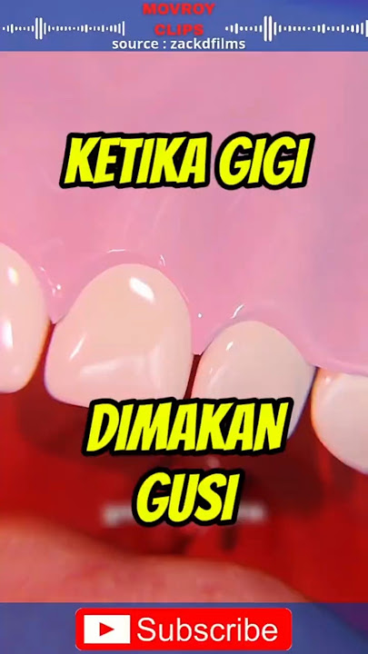 Cara dokter menangani gusi yang menutupi gigi. #edukasi #faktaunik