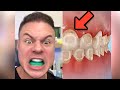 Can You Whiten Your Teeth With Braces? Experiment Update!