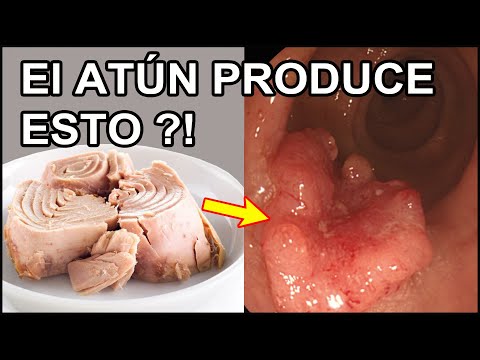 El ATÚN le va a producir ESTO al Cuerpo, Si lo comes Así