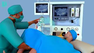 IUI 3D Medical Animation by AniBuddy Animation Studio | IVF - IUI Process for Candor IVF Centre