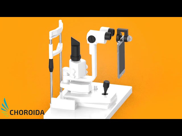 Smartphone adaptor for surgical microscopes. - Choroida