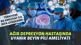 Ağir Depresyon Tedavi̇si̇nde Beyi̇n Pi̇li̇ Ameli̇yati