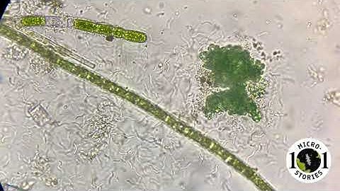 Spirilla bacteria swimming