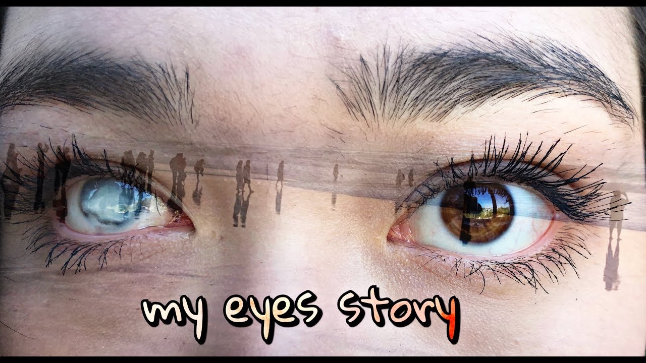 MY STORY. WHY DO I HAVE DIFFERENT COLORED EYES. - YouTube