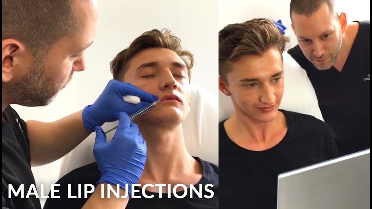 Young Man Getting Lip Enhancement Treatment | Male Lip ...