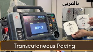 منظم  ضربات القلب: عربة الطوارئ 4 [Transcutaneous Pacing]