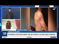 MAURICIO DONATI | UN TRABAJADOR COMUNAL TERMINÓ HOSPITALIZADO TRAS UN ATAQUE